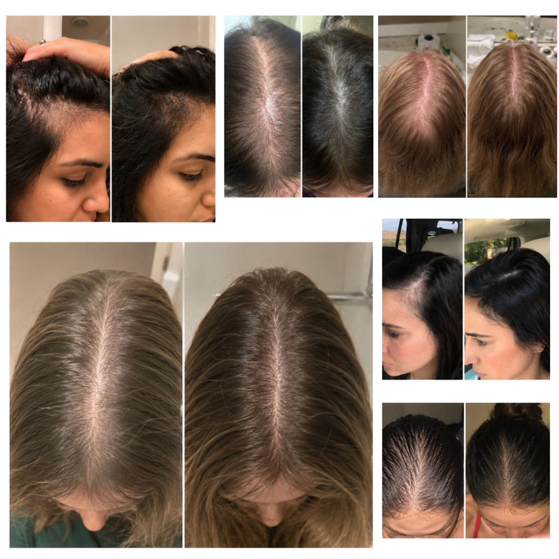 Go From Dreading Hair Wash Day to Looking Forward to Styling Your Hair Again with Vyrex Hair Support Complex